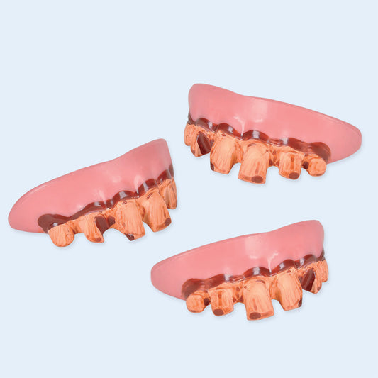 DENTS MOCHES